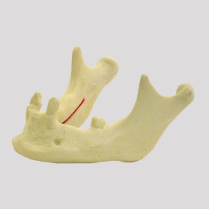 MANDIBULA RADIOPACA COM CANINO E 2º MOLAR ESQUERDO - cód. 12287