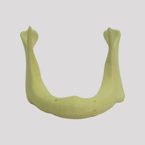 MANDÍBULA EDÊNTULA COM REABSORÇÃO ÓSSEA I - cód. 4010 AT-01