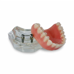 MAXILA ACRILICA BARRA CLIP - cód. 4215 A