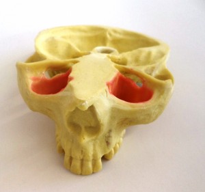 MAXILA RADIOPACA COM CANINO + 3º MOLAR INCLUSO - cód. 12297