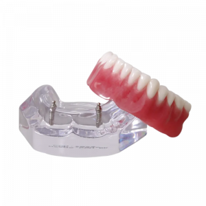 MANDÍBULA ACRÍLICA COM 2 O'RINGS + PRÓTESE - cód. 9566