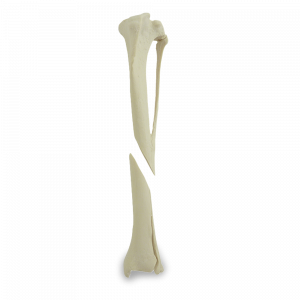 TÍBIA ESQUERDA COM CANAL MEDULAR E ESPONJOSO COM FRATURA DISTAL - CÃO GRANDE - cód. AV260ESPF2