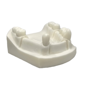 MANDÍBULA COM AUSÊNCIAS PARCIAIS - DENTES 31, 32, 36, 41, 42, 44, 45 e 46 - cód. 4701