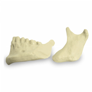 1/2 MANDÍBULA ESQUERDA COM CORTE DE OSTEOTOMIA SAGITAL - cód. 4029