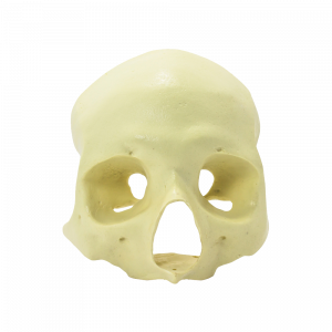 CRÂNIO FRONTAL All-on-4® ZIGOMA - cód. 9014