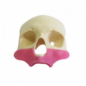 CRANIO FRONTAL All-on-4® ZIGOMA COM GENGIVA - cód. 9014 G