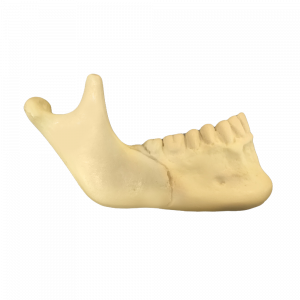 HEMI-MANDIBULA OSTETOMIA SAGITAL CONVENCIONAL - cód. 11976