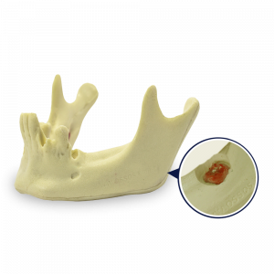 MANDIBULA COM 3º MOLAR INCLUSO - cód. 4401-02