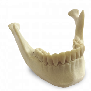 MANDIBULA COM DENTES 38 E 48 INCLUSOS - cód. 12275