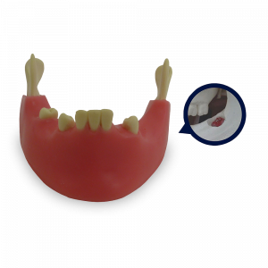 MANDIBULA COM 3º MOLAR INCLUSO E GENGIVA - cód. 4401G-02