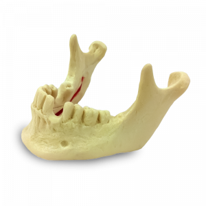 MANDÍBULA COM NERVO MANDIBULAR E AUSÊNCIA DENTES 33 E 46 - cód. 4058