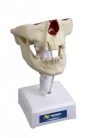 MANEQUIM PRE MOLAR COM ALGUNS DENTES E DEFEITO NA TABUA - cód. 4004
