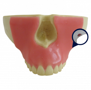 MAXILA COM TODOS OS DENTES, GENGIVA E 3º MOLAR INCLUSO - cód. 4402 G-01