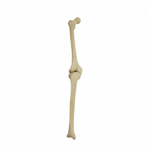 JOELHO DIREITO COM CANAL MEDULAR E SIMULAÇÃO DE LIGAMENTOS - cód. 2040BD
