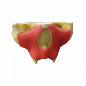 MAXILA COM GENGIVA E AUSÊNCIA DOS DENTES 11/12 / 21 E 22 - cód. 9971 SGT