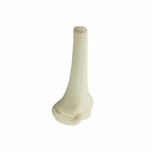 FEMUR DISTAL DIREITO INFANTO JUVENIL - cód. 1013 D
