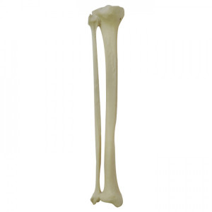 MODELO DE TIBIA RADIOPACA ESQUERDA COM CANAL MEDULAR E ESPONJOSO + FIBULA - cód. 12376
