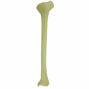TÍBIA ESQUERDA COM DEFORMIDADE PROXIMAL VARO ROTAÇÃO INTERNA - cód. 2026 DPVR