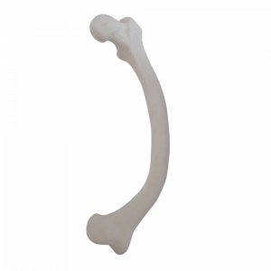 FEMUR  ESQUERDO DE RAQUITISMO VARO DUPLO - cód. 2025 RVD