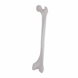 FÊMUR DIREITO COM DEFORMIDADE DISTAL VARO - cód. 2030 DDVR
