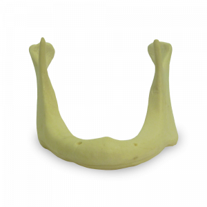 MANDÍBULA EDÊNTULA COM REABSORÇÃO ÓSSEA I - cód. 4010 AT-01