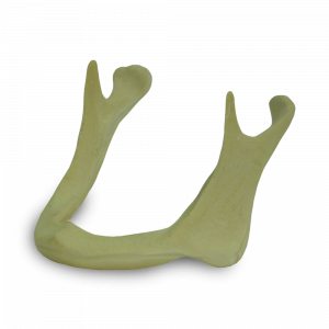 MANDÍBULA EDÊNTULA COM REABSORÇÃO ÓSSEA IV - cód. 4010 AT-04 