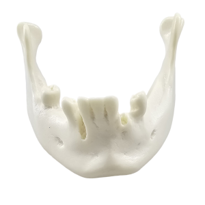 MANDÍBULA COM ALGUNS DENTES E EXTRAÇÃO RECENTE - CONTÉM DENTES 31, 34, 41, 42, 44 e 47 - cód. 4012