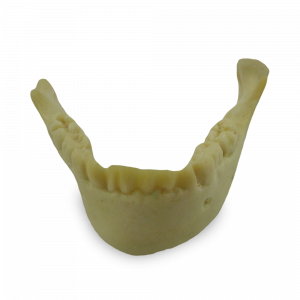MANDIBULA INFANTIL COM TODOS OS DENTES E DEFORMIDADE - cód. 4013 - 2