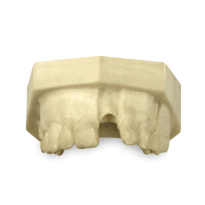 MAXILA COM AUSÊNCIA PARCIAL 03 - DENTE 21, 24, 15, 16 e 17 - cód. 4803