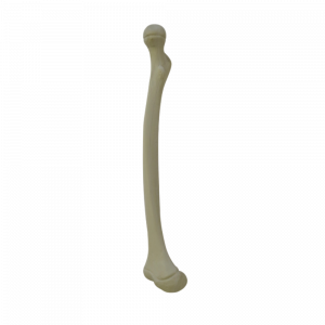 FEMUR DIREITO INFANTIL COM CANAL E DEFORMIDADE ANTEVERSÃO - cód. 1018