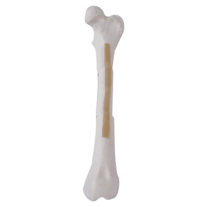FÊMUR ESQUERDO ESPONJOSO COM FRATURAS MULTIPLAS 2 - CÃO GRANDE PORTE - cód. AV250ESPF3