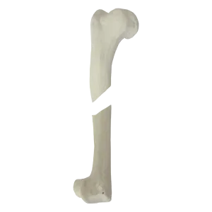 ÚMERO DIREITO COM CANAL MEDULAR E ESPONJOSO COM FRATURA NO CÓRTICO LATERAL - CÃO GRANDE PORTE - cód. AV300ESPF1